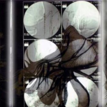 Картина под названием "RADIOGRAFIE" - Anatomic Stylism, Подлинное произведение искусства