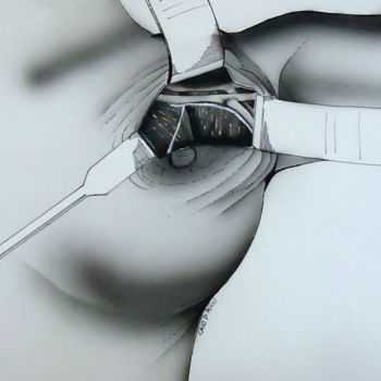 Pintura titulada "cirurgico-1.jpg" por Caio Ricci, Obra de arte original