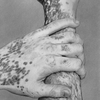 Dibujo titulada "Vitiligo" por Marion Roy, Obra de arte original, Lápiz