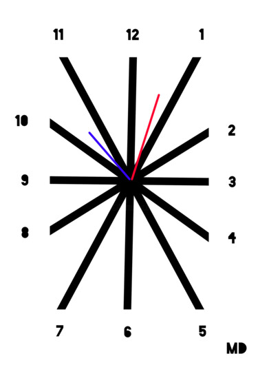 Arts numériques intitulée "Cadran" par Mathieu Dudognon, Œuvre d'art originale, Travail numérique 2D Monté sur Plexiglas