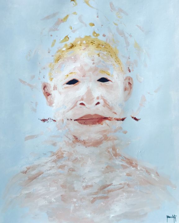 Painting titled "Albinism" by Bechti, Original Artwork