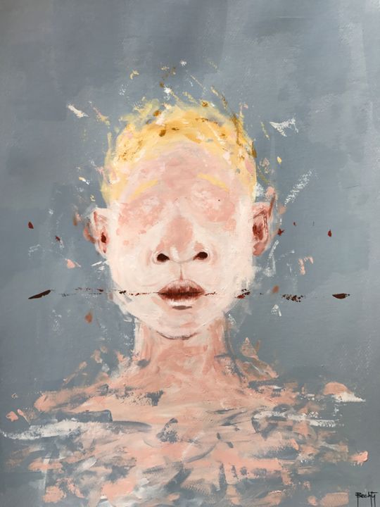 Painting titled "Albinism 04" by Bechti, Original Artwork