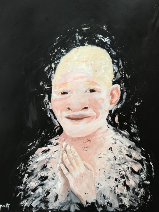 Painting titled "Albinism 05" by Bechti, Original Artwork