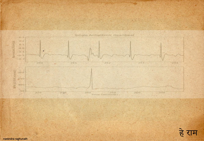 Fotografie mit dem Titel "Single arrhythmic h…" von Narendraraghunath, Original-Kunstwerk