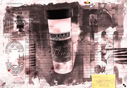Arts numériques intitulée "inflammation" par Arno Peters, Œuvre d'art originale,