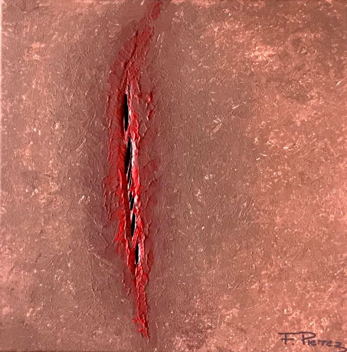 Painting titled "Injury" by Fabrice Pierrez, Original Artwork, Acrylic