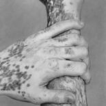 Dessin intitulée "Vitiligo" par Marion Roy, Œuvre d'art originale, Crayon
